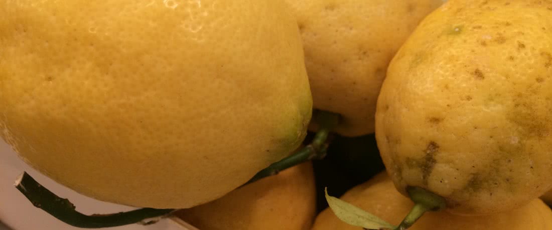 Disturbi del Comportamento Alimentare